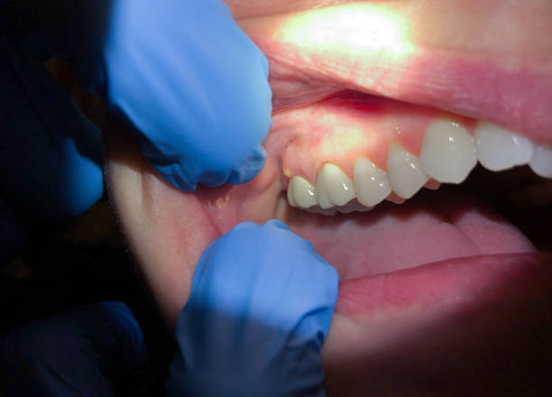 Best 24-Hour Emergency Dental Care in Valenti, NE